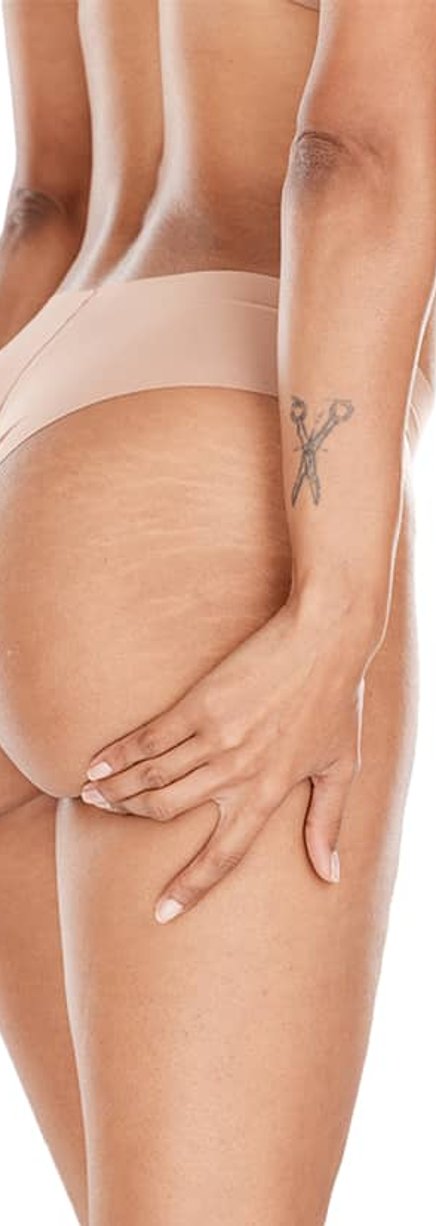 Back tattoo featuring floral linework